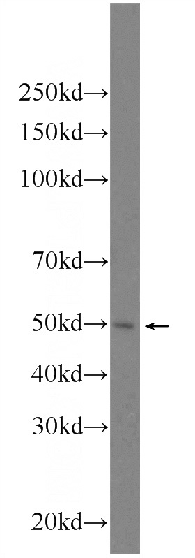 HeLa cells were subjected to SDS PAGE followed by western blot with Catalog No:110759(FYTTD1 Antibody) at dilution of 1:300