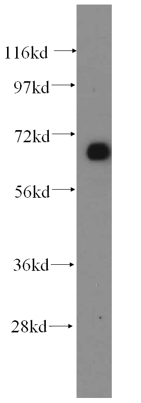 mouse kidney tissue were subjected to SDS PAGE followed by western blot with Catalog No:110947(GFM1 antibody) at dilution of 1:500