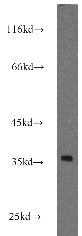 HeLa cells were subjected to SDS PAGE followed by western blot with Catalog No:114907(RPS3A antibody) at dilution of 1:800