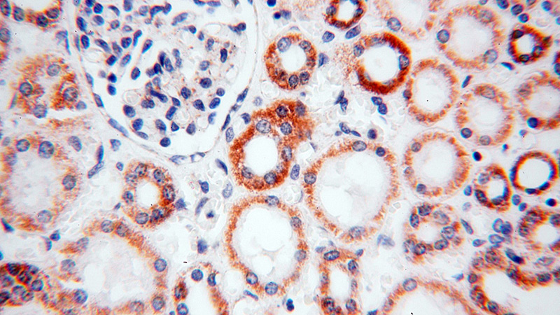 Immunohistochemical of paraffin-embedded human kidney using Catalog No:113071(NDUFB11 antibody) at dilution of 1:100 (under 40x lens)
