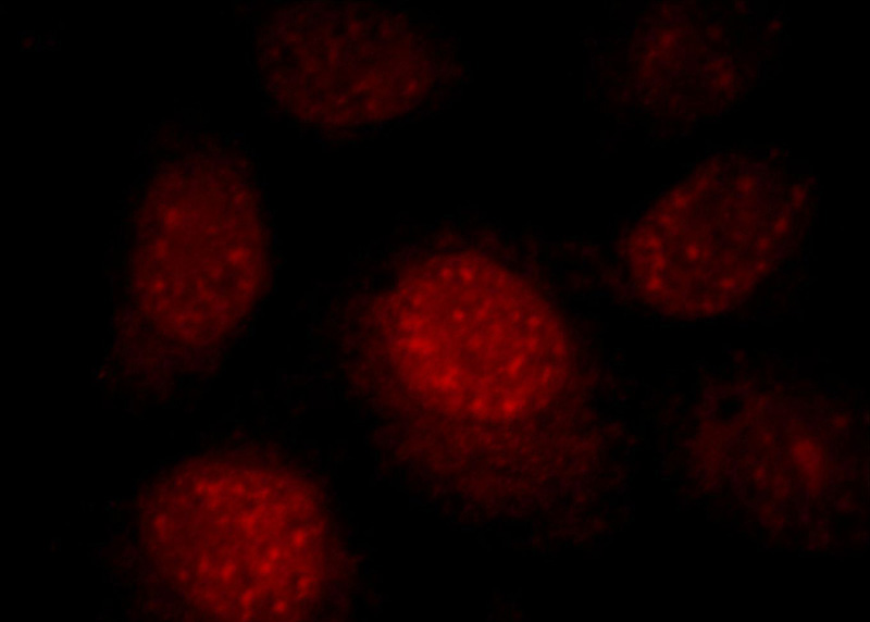 Immunofluorescent analysis of HepG2 cells, using RNF168 antibody Catalog No:114746 at 1:25 dilution and Rhodamine-labeled goat anti-rabbit IgG (red).
