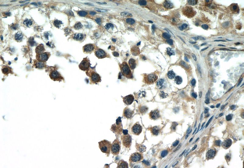 Immunohistochemistry of paraffin-embedded human testis tissue slide using Catalog No:117106(BCMO1 Antibody) at dilution of 1:50 (under 40x lens)