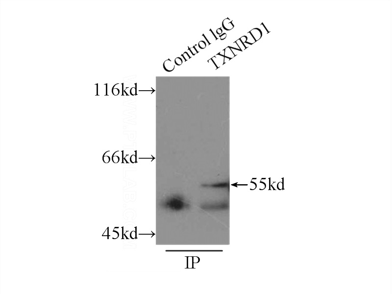IP Result of anti-TXNRD1 (IP:Catalog No:116458, 3ug; Detection:Catalog No:116458 1:500) with Jurkat cells lysate 1500ug.