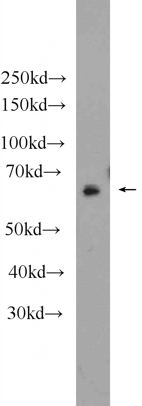 mouse ovary tissue were subjected to SDS PAGE followed by western blot with Catalog No:113270(NR5A2 Antibody) at dilution of 1:1000