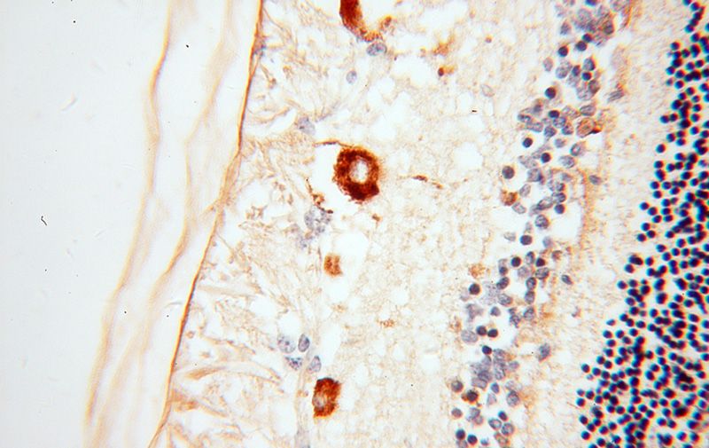 Immunohistochemical of paraffin-embedded human eye using Catalog No:114561(RBP3 antibody) at dilution of 1:50 (under 40x lens)