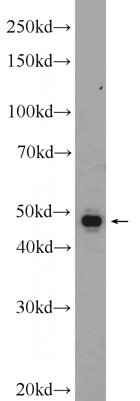 SH-SY5Y cells were subjected to SDS PAGE followed by western blot with Catalog No:108892(CTSH Antibody) at dilution of 1:600