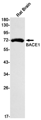Western blot detection of BACE1 in Rat Brain lysates using BACE1 Rabbit mAb(1:1000 diluted).Predicted band size:56kDa.Observed band size:70kDa.