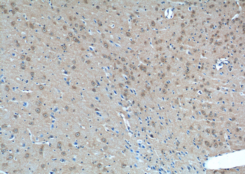 Immunohistochemistry of paraffin-embedded mouse brain tissue slide using Catalog No:108125(AP3M2 Antibody) at dilution of 1:50 (under 10x lens)
