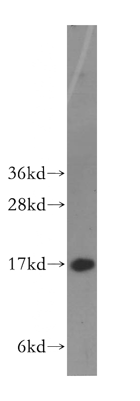 HepG2 cells were subjected to SDS PAGE followed by western blot with Catalog No:111486(HMGN1 antibody) at dilution of 1:500