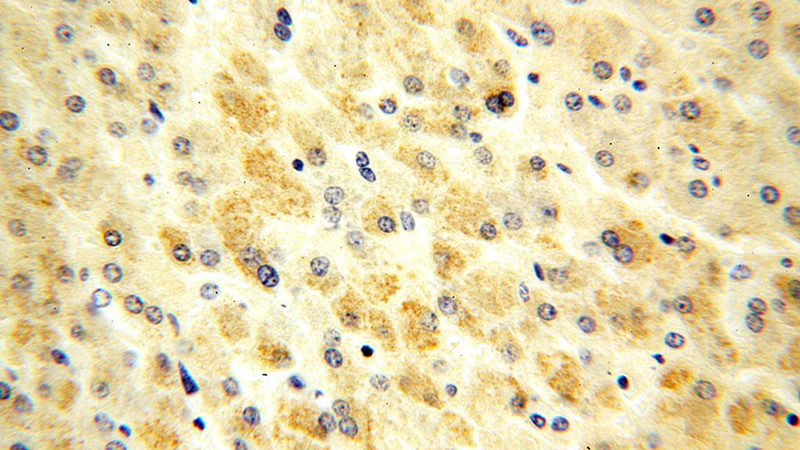 Immunohistochemical of paraffin-embedded human brain using Catalog No:113332(OGDHL antibody) at dilution of 1:100 (under 40x lens)