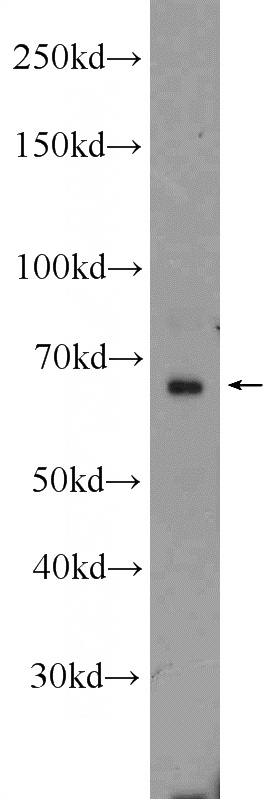 Raji cells were subjected to SDS PAGE followed by western blot with Catalog No:107937(AKNA Antibody) at dilution of 1:600
