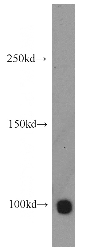 K-562 cells were subjected to SDS PAGE followed by western blot with Catalog No:111400(HELLS antibody) at dilution of 1:500