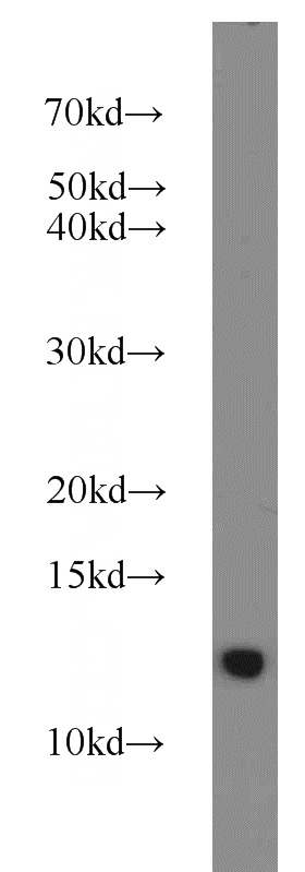 U-937 cells were subjected to SDS PAGE followed by western blot with Catalog No:110672(FKBP1B antibody) at dilution of 1:1000