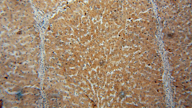 Immunohistochemical of paraffin-embedded human liver using Catalog No:109690(CYP27A1 antibody) at dilution of 1:50 (under 10x lens)