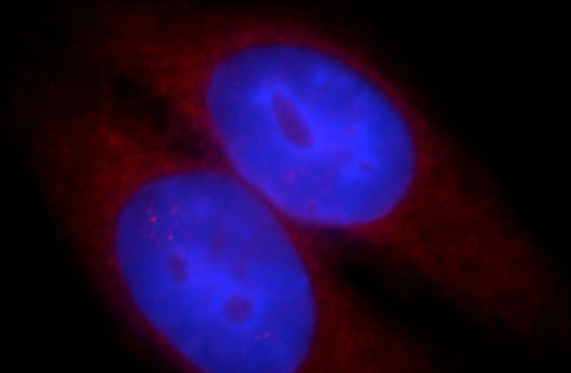 Immunofluorescent analysis of HepG2 cells, using WASL antibody Catalog No:116843 at 1:25 dilution and Rhodamine-labeled goat anti-rabbit IgG (red). Blue pseudocolor = DAPI (fluorescent DNA dye).