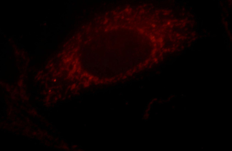 Immunofluorescent analysis of HepG2 cells, using CALD1 antibody Catalog No:108821 at 1:25 dilution and Rhodamine-labeled goat anti-rabbit IgG (red).