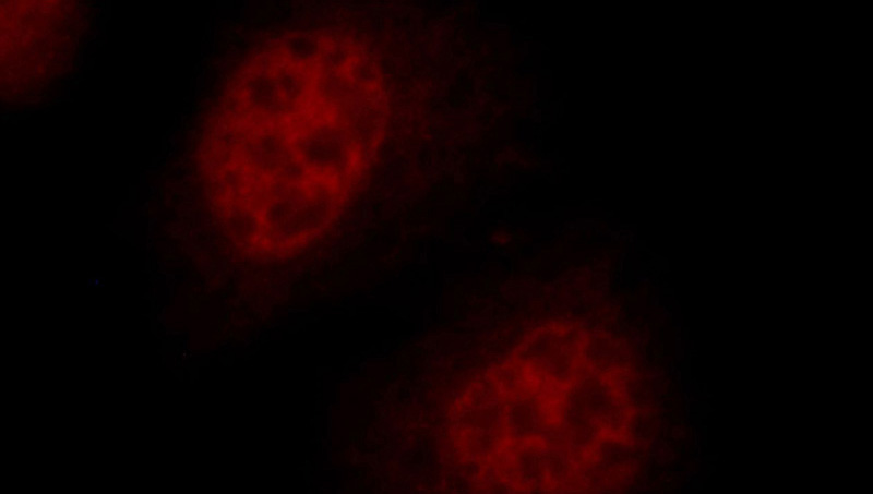 Immunofluorescent analysis of HepG2 cells, using RFC4 antibody Catalog No:114625 at 1:25 dilution and Rhodamine-labeled goat anti-rabbit IgG (red).