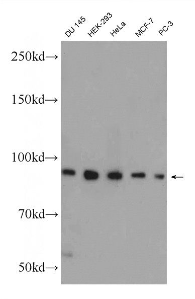 DU 145 cells were subjected to SDS PAGE followed by western blot with Catalog No:110271(ELAC2 Antibody) at dilution of 1:300