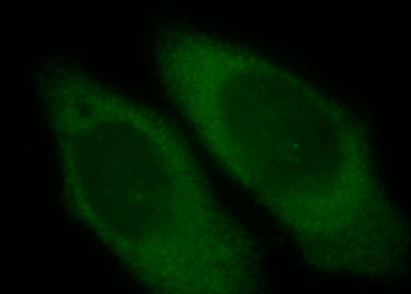 Immunofluorescent analysis of HepG2 cells, using CEPT1 antibody Catalog No:109189 at 1:25 dilution and FITC- labeled goat anti-Rabbit IgG (green).