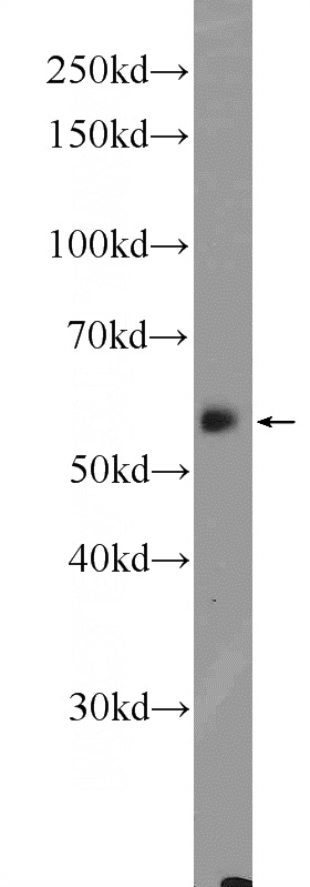 mouse liver tissue were subjected to SDS PAGE followed by western blot with Catalog No:109690(CYP27A1 Antibody) at dilution of 1:600