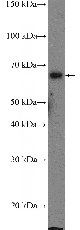 HEK-293 cells were subjected to SDS PAGE followed by western blot with Catalog No:110816(GAD1 Antibody) at dilution of 1:600
