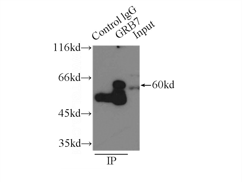 IP Result of anti-GRB7 (IP:Catalog No:111201, 3ug; Detection:Catalog No:111201 1:500) with A431 cells lysate 3300ug.