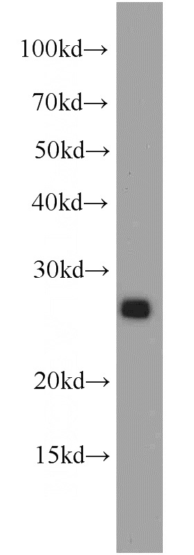 Jurkat cells were subjected to SDS PAGE followed by western blot with Catalog No:114326(PTPRCAP antibody) at dilution of 1:200