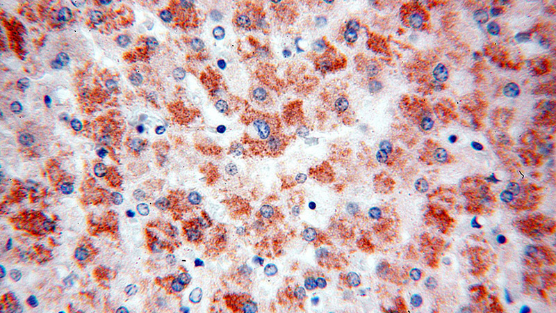 Immunohistochemical of paraffin-embedded human liver using Catalog No:116234(TRAF6 antibody) at dilution of 1:50 (under 40x lens)