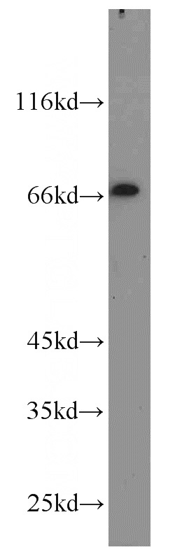 SH-SY5Y cells were subjected to SDS PAGE followed by western blot with Catalog No:114071(POU3F3-Specific antibody) at dilution of 1:1000