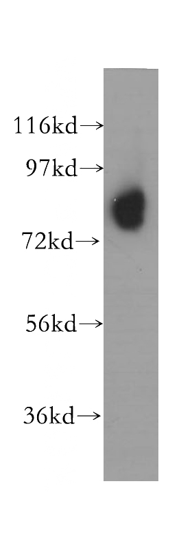 human kidney tissue were subjected to SDS PAGE followed by western blot with Catalog No:113081(NDUFS1 antibody) at dilution of 1:400