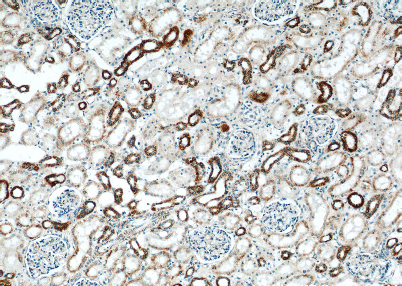 Immunohistochemistry of paraffin-embedded human kidney slide using Catalog No:108350(ATP5A1 Antibody) at dilution of 1:50