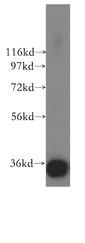 human testis tissue were subjected to SDS PAGE followed by western blot with Catalog No:114155(PPP6C antibody) at dilution of 1:500