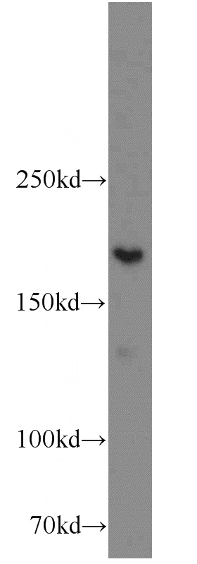 HeLa cells were subjected to SDS PAGE followed by western blot with Catalog No:116877(XRN1 antibody) at dilution of 1:600