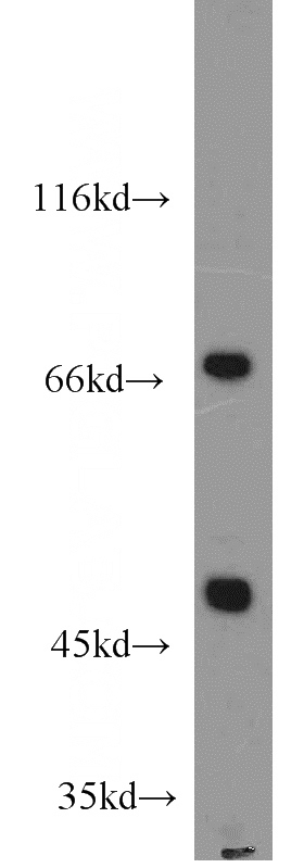 mouse heart tissue were subjected to SDS PAGE followed by western blot with Catalog No:109296(CHST15 antibody) at dilution of 1:500