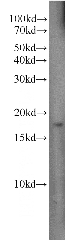 HeLa cells were subjected to SDS PAGE followed by western blot with Catalog No:111325(H3F3B antibody) at dilution of 1:300