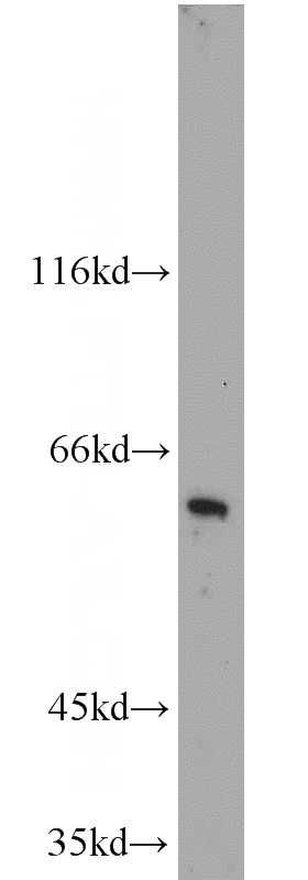 human liver tissue were subjected to SDS PAGE followed by western blot with Catalog No:115380(SLC47A1 antibody) at dilution of 1:1000