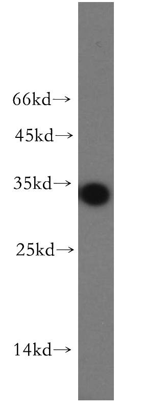 MCF7 cells were subjected to SDS PAGE followed by western blot with Catalog No:113467(ocIAD1 antibody) at dilution of 1:300