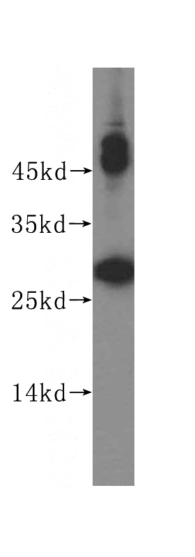 Jurkat cells were subjected to SDS PAGE followed by western blot with Catalog No:114941(RWDD1 antibody) at dilution of 1:400