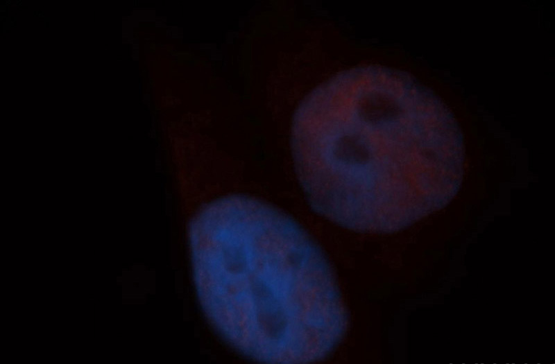 Immunofluorescent analysis of HepG2 cells, using SIN3A antibody Catalog No:115234 at 1:50 dilution and Rhodamine-labeled goat anti-rabbit IgG (red). Blue pseudocolor = DAPI (fluorescent DNA dye).