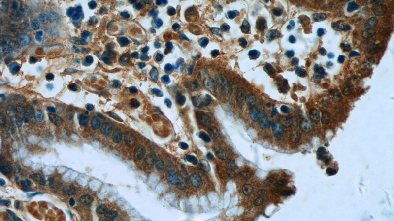 Immunohistochemistry of paraffin-embedded human stomach tissue slide using Catalog No:108294(ATG2B Antibody) at dilution of 1:50 (under 40x lens)