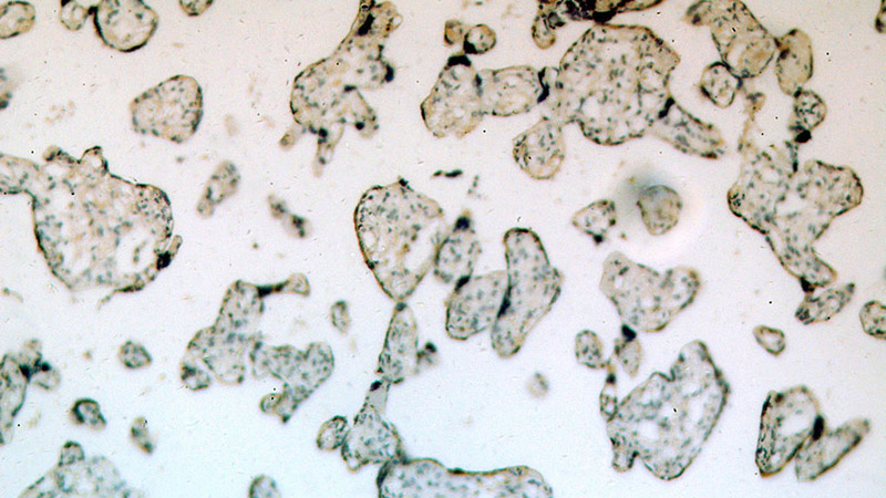 Immunohistochemical of paraffin-embedded human placenta using Catalog No:115307(SLC18A1 antibody) at dilution of 1:100 (under 10x lens)