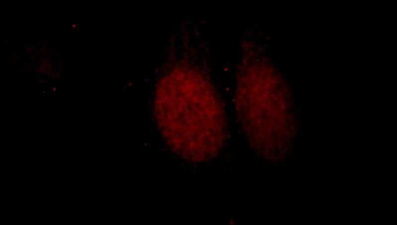 Immunofluorescent analysis of HepG2 cells, using DPF2 antibody Catalog No:110064 at 1:25 dilution and Rhodamine-labeled goat anti-rabbit IgG (red).