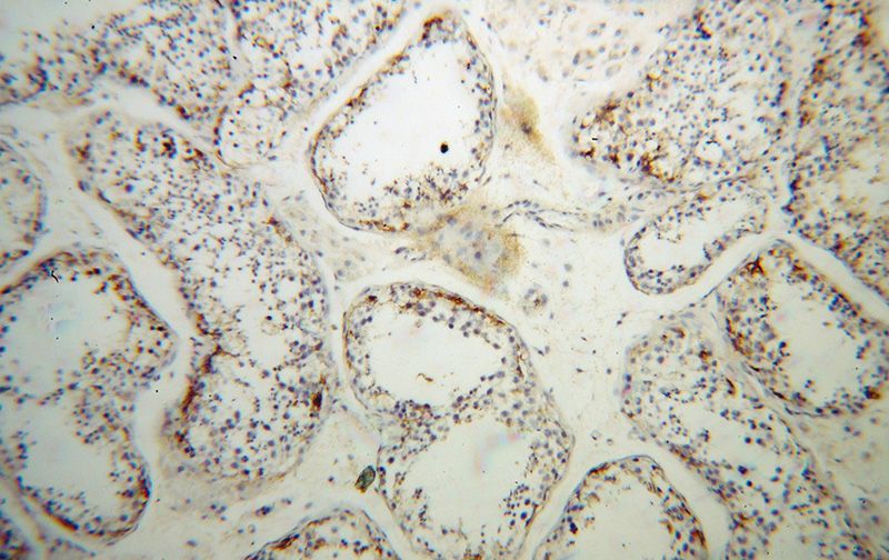 Immunohistochemical of paraffin-embedded human testis using Catalog No:111672(IFT81 antibody) at dilution of 1:50 (under 10x lens)