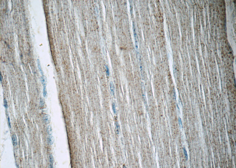 Immunohistochemistry of paraffin-embedded human skeletal muscle tissue slide using Catalog No:108133(ANAPC11 Antibody) at dilution of 1:50(under 40x lens)