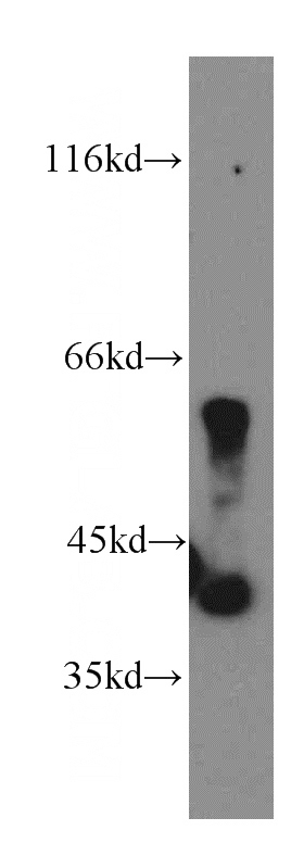 HepG2 cells were subjected to SDS PAGE followed by western blot with Catalog No:113571(PANK3 antibody) at dilution of 1:500