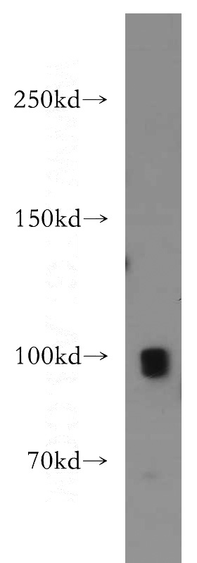 mouse brain tissue were subjected to SDS PAGE followed by western blot with Catalog No:116406(TRPC4 antibody) at dilution of 1:500