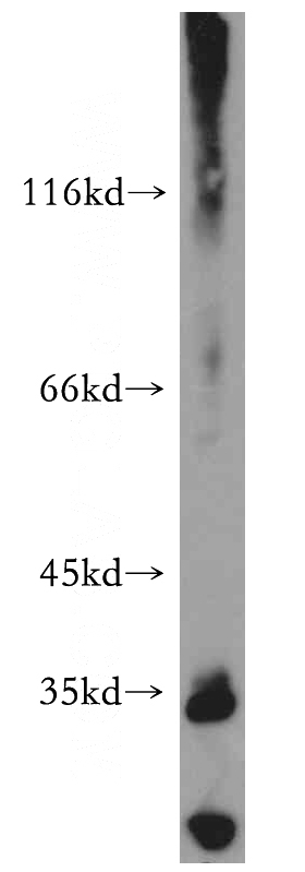 A431 cells were subjected to SDS PAGE followed by western blot with Catalog No:108148(ARMC10 antibody) at dilution of 1:500