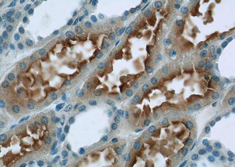 Immunohistochemistry of paraffin-embedded human kidney tissue slide using Catalog No:113808(PHF14 Antibody) at dilution of 1:50 (under 40x lens)