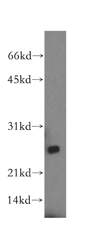 mouse skeletal muscle tissue were subjected to SDS PAGE followed by western blot with Catalog No:112411(LYPLAL1 antibody) at dilution of 1:400