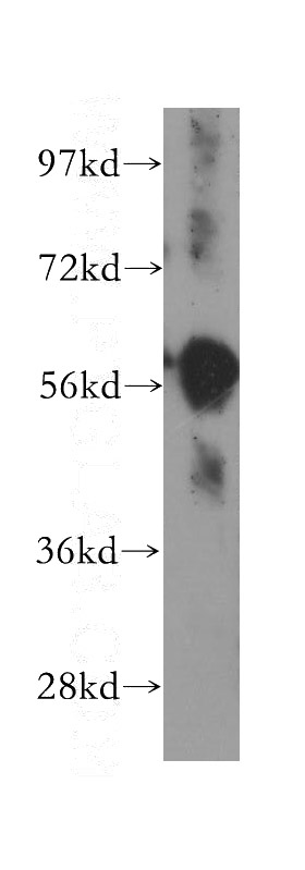 Jurkat cells were subjected to SDS PAGE followed by western blot with Catalog No:111418(HLA-DMA antibody) at dilution of 1:1500